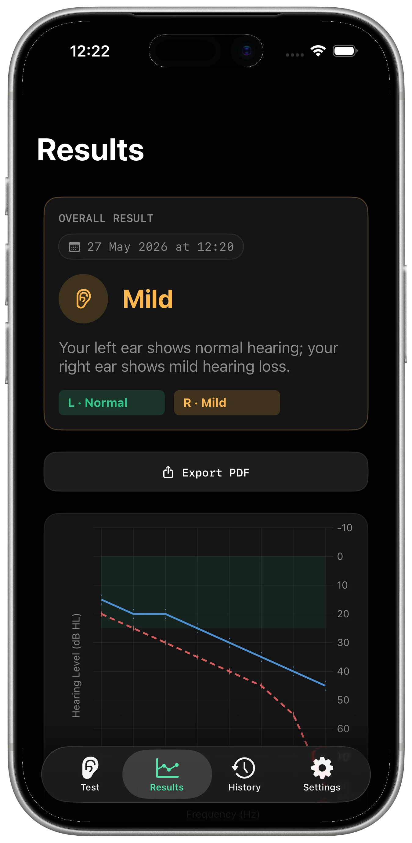 HearTest hearing check screen with test controls